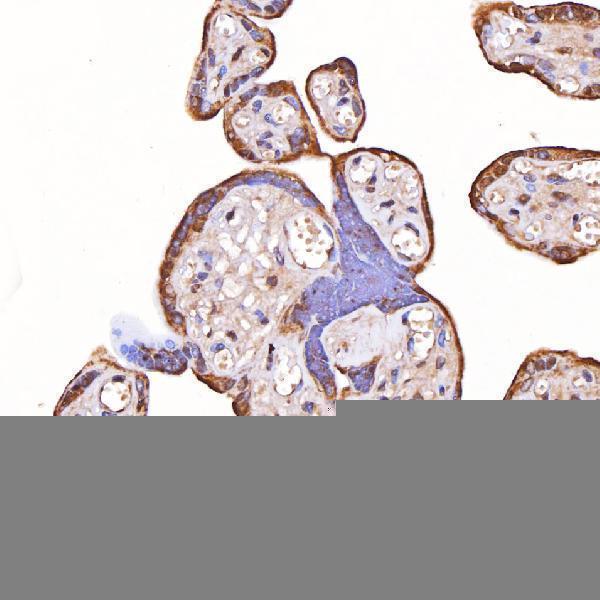 a06775 1 tomm34 primary antibodies ihc testing 6