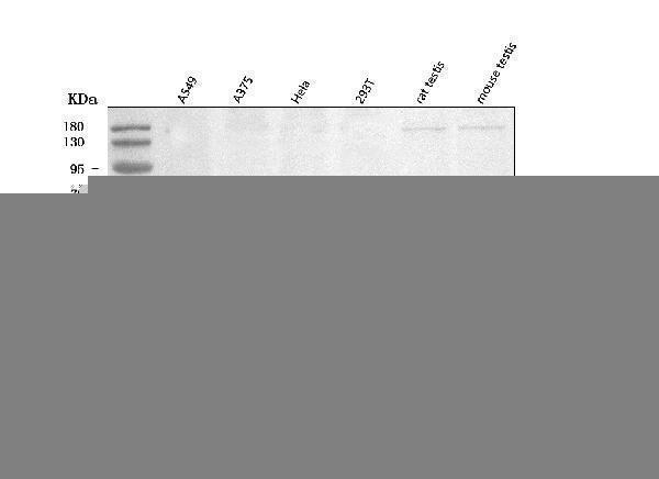  Western blot analysis of TOMM34 using anti-TOMM34 antibody (A06775-1)