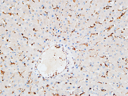 Immunohistochemical analysis of paraffin-embedded Human liver