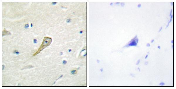 Immunohistochemistry analysis of paraffin-embedded human brain tissue, using SEMA4A Antibody
