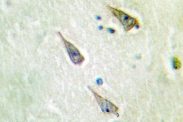 Immunohistochemistry (IHC) analyzes of SEMA4A (N532) pAb in paraffin-embedded human brain tissue
