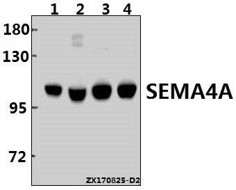 Western blot (WB) analysis of SEMA4A (N532) pAb at 1:500 dilution
Lane1:MCF-7 whole cell lysate(40ug)
Lane2:K562 whole cell lysate(40ug)
Lane3:H9C2 whole cell lysate(40ug)
Lane4:BV2 whole cell lysate(40ug)