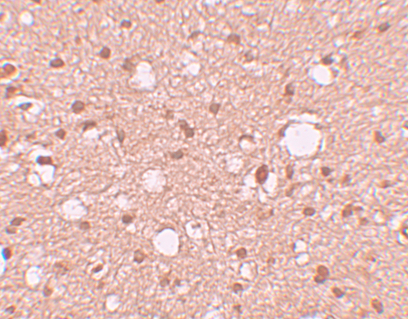 a06783 1 apba2 primary antibodies ihc testing 2