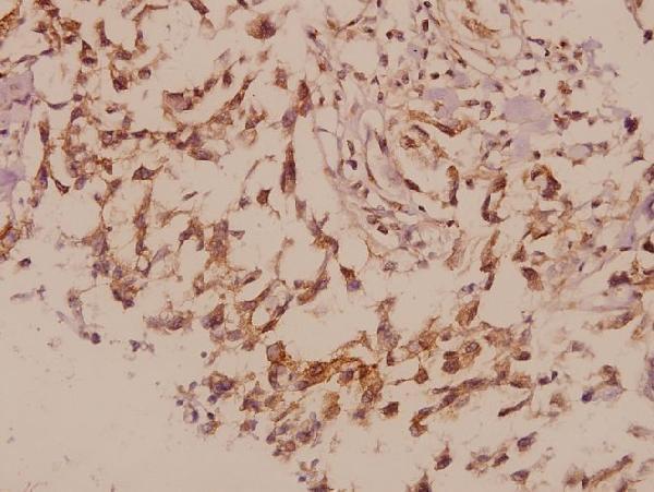 a06787s454 prph primary antiboties ihc testing 2
