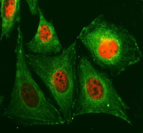 a06789 1 foxj2 primary antibodies if testing 1