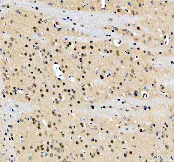 a06789 1 foxj2 primary antibodies ihc testing 1