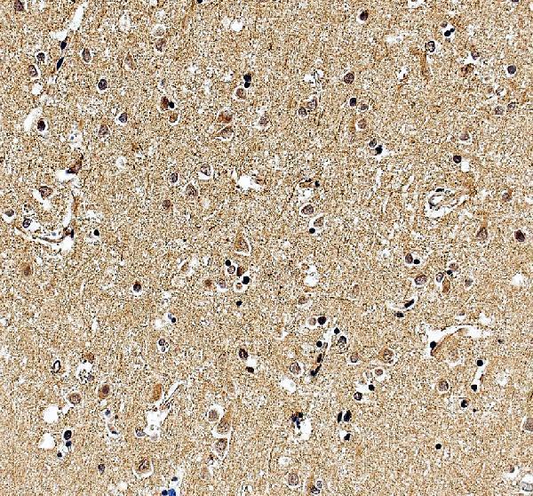 a06789 1 foxj2 primary antibodies ihc testing 2