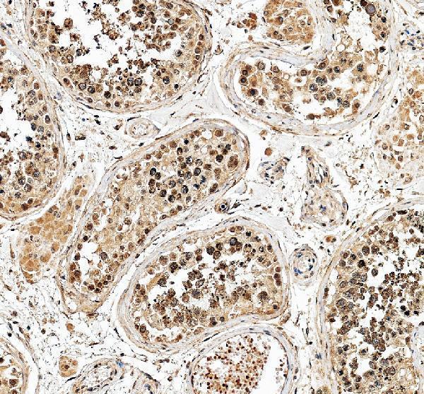 a06789 1 foxj2 primary antibodies ihc testing 3