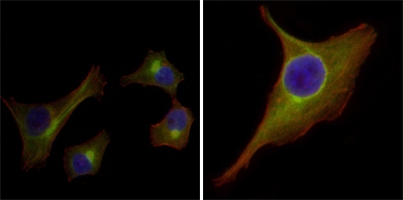 a06791 1 krt15 primary antibodyes if testing 2