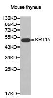 a06791 2 krt15 primary antiboties wb testing 1