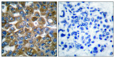 Immunohistochemistry validation of KRT15 using Anti-Cytokeratin 15 KRT15 Antibody (A06791-3)