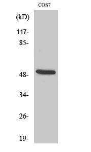 Western blotting validation for Anti-Cytokeratin 15 KRT15 Antibody A06791-3
Western Blot (WB) analysis of specific cells using Anti-Cytokeratin 15 polyclonal antibody