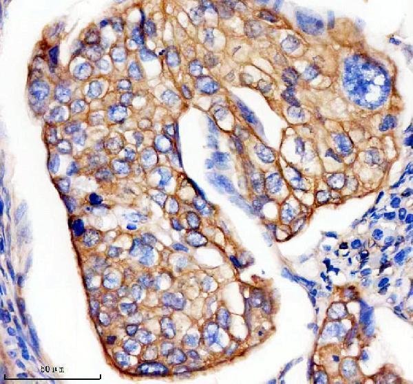 a06791 4 krt15 primary antibodies ihc testing 1
