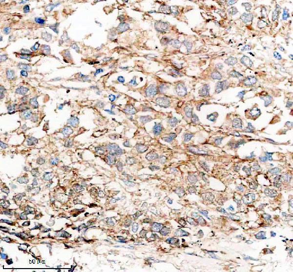 a06791 4 krt15 primary antibodies ihc testing 2