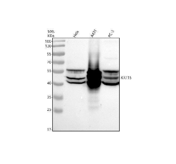 a06791 4 krt15 primary antibodies wb testing 1