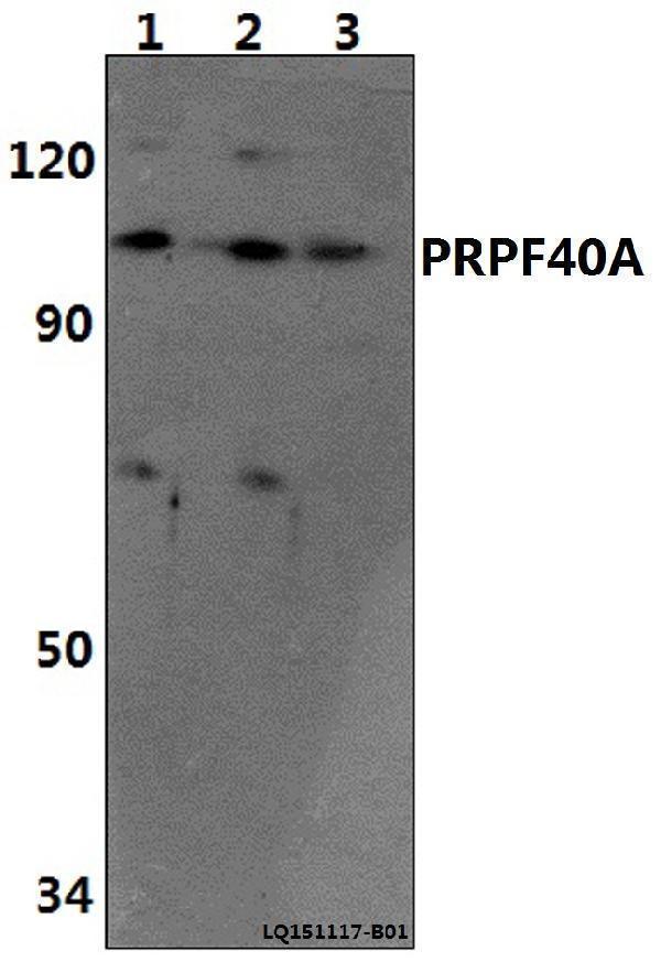 a06792 prpf40a primary antiboties wb testing 1