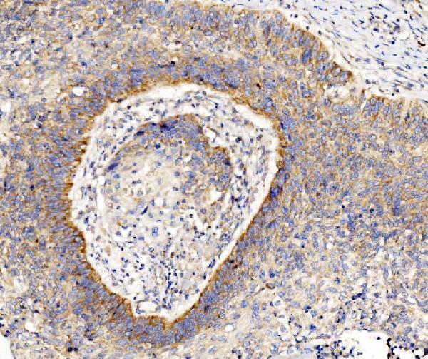  IHC analysis of RPL8 using anti-RPL8 antibody (A06793-1)