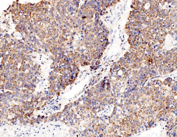  IHC analysis of RPL8 using anti-RPL8 antibody (A06793-1)