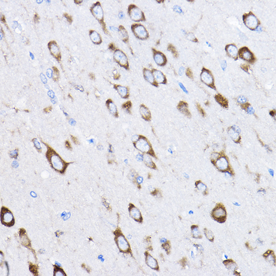 a06793 rpl8 primary antiboties ihc testing 2
