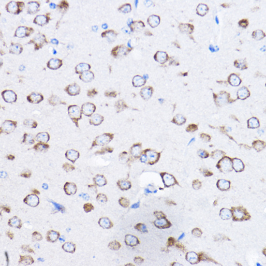 a06793 rpl8 primary antiboties ihc testing 3