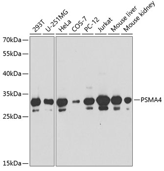 a06794 psma4 primary antiboties wb testing 1