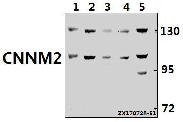 Western blot (WB) analysis of CNNM2 polyclonal antibody at 1:500 dilution
Lane1:CT26 whole cell lysate(40ug)
Lane2:U-87MG whole cell lysate(40ug)
Lane3:PC12 whole cell lysate(40ug)
Lane4:A549 whole cell lysate(40ug)
Lane5:HepG2 whole cell lysate(40ug)