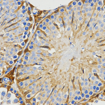 a06797 piwil4 primary antiboties ihc testing 2