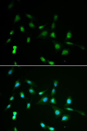 a06797 piwil4 primary antiboties ihc testing 3