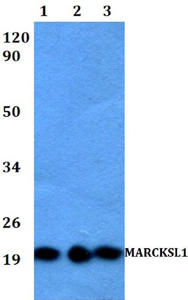 Western blot (WB) analysis of MARCKSL1 polyclonal antibody at 1:500 dilution
Lane1:HEK293Twhole cell lysate
Lane2:Raw264