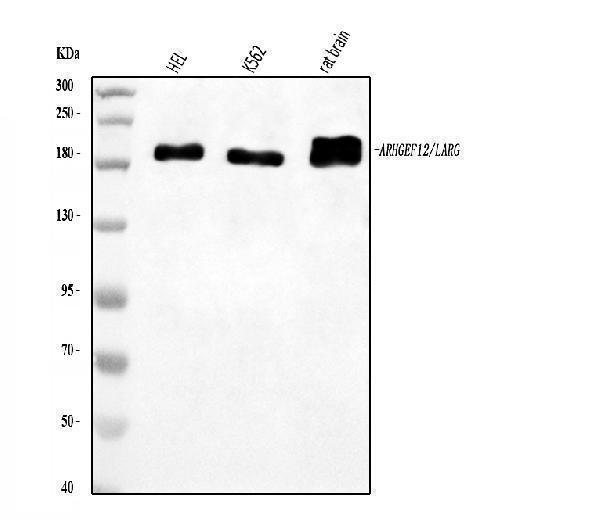  Western blot analysis of LARG/ARHGEF12 using anti-LARG/ARHGEF12 antibody (A06802-2)