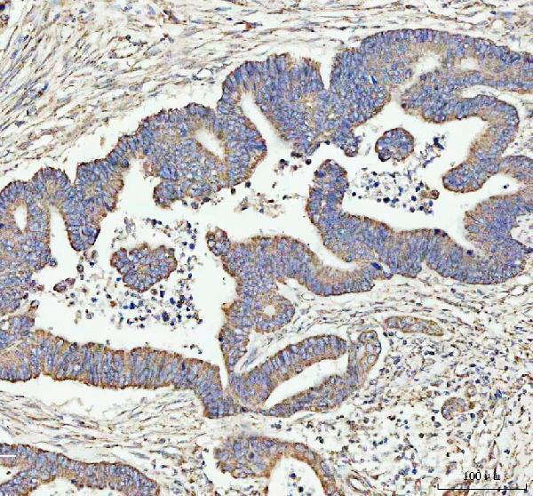  IHC analysis of ARHGEF12L using anti-ARHGEF12L antibody (A06802-3)
