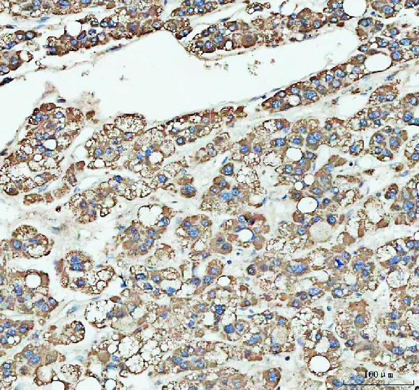  IHC analysis of ARHGEF12L using anti-ARHGEF12L antibody (A06802-3)