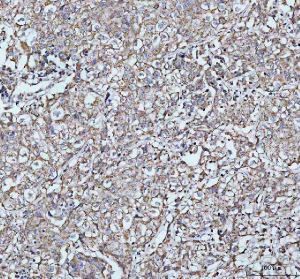 a06802 3 arhgef12 primary antibodies ihc testing 4