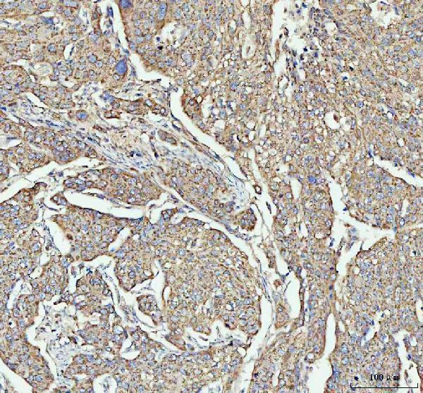 a06802 3 arhgef12 primary antibodies ihc testing 5
