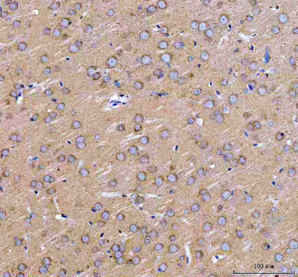 a06802 3 arhgef12 primary antibodies ihc testing 6