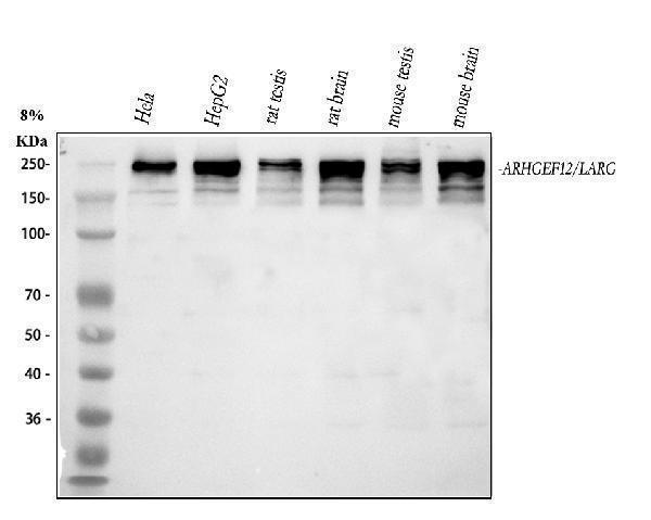  Western blot analysis of LARG/ARHGEF12 using anti-LARG/ARHGEF12 antibody (A06802-3)