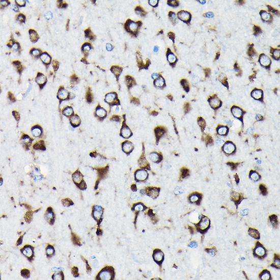 Immunohistochemistry of paraffin-embedded rat brain using RPL23A Rabbit pAb  at dilution of 1:100 