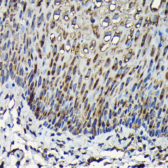 Immunohistochemistry of paraffin-embedded human esophageal using RPL23A Rabbit pAb  at dilution of 1:100 