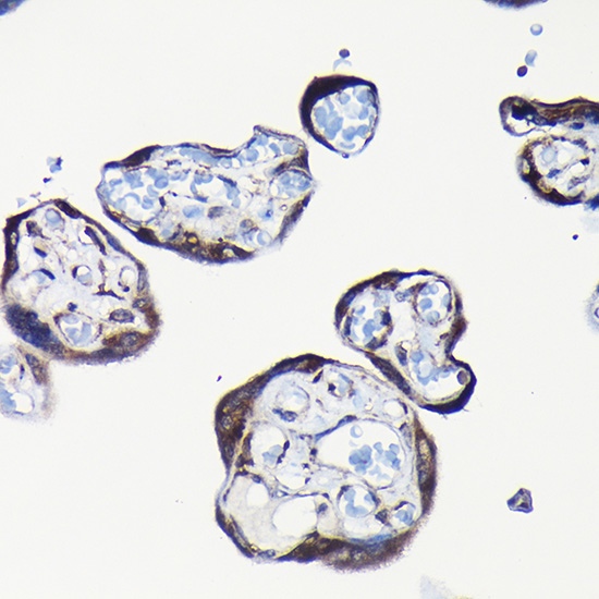 a06803 rpl23a primary antiboties ihc testing 4