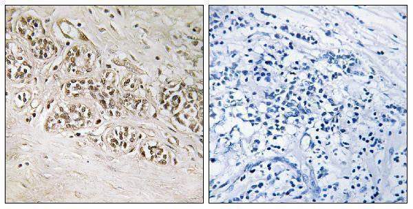 a06804 rad54b primary antibodies ihc testing 1