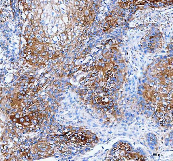  IHC analysis of IARS1 using anti-IARS1 antibody (A06805-1)