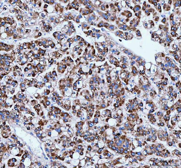  IHC analysis of IARS1 using anti-IARS1 antibody (A06805-1)