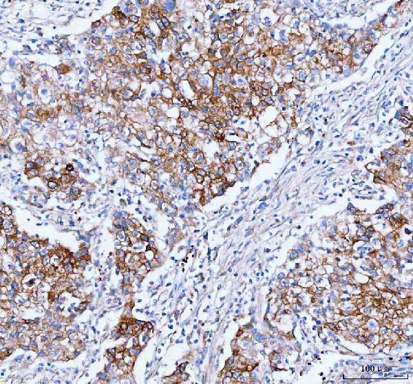 a06805 1 iars primary antibodies ihc testing 4