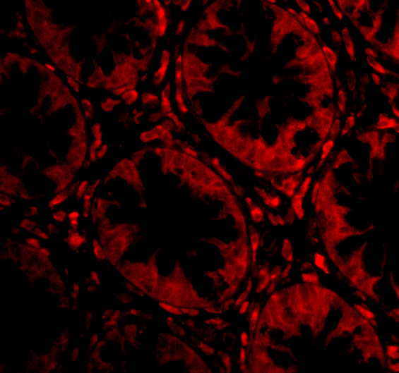Immunofluorescence of TEM2 in Human Colon cells with TEM2 antibody at 20 μg/mL