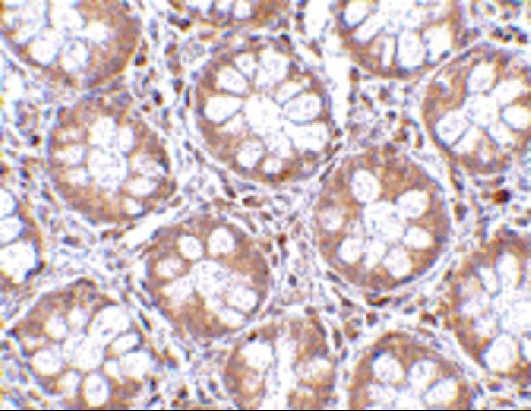 Immunohistochemistry of TEM2 in human colon tissue with TEM2 antibody at 2