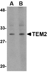 Western blot analysis of TEM2 in human colon tissue lysate with TEM2 antibody at (A) 1 and (B) 2 μg/mL