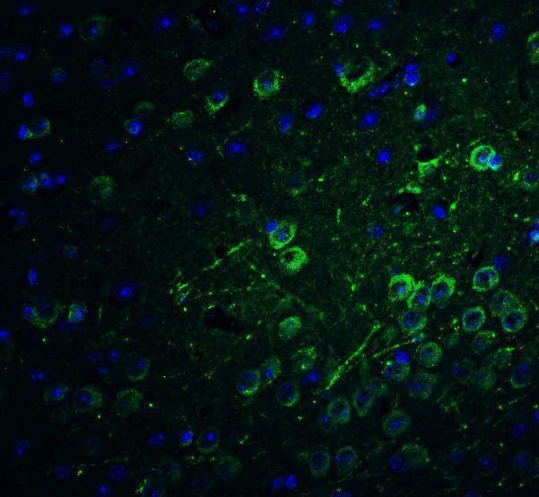a06811 1 pacs1 primary antibodies if testing 4