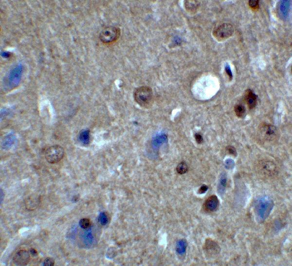 a06811 1 pacs1 primary antibodies ihc testing 2