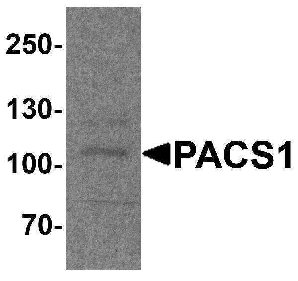 a06811 1 pacs1 primary antibodies wb testing 1
