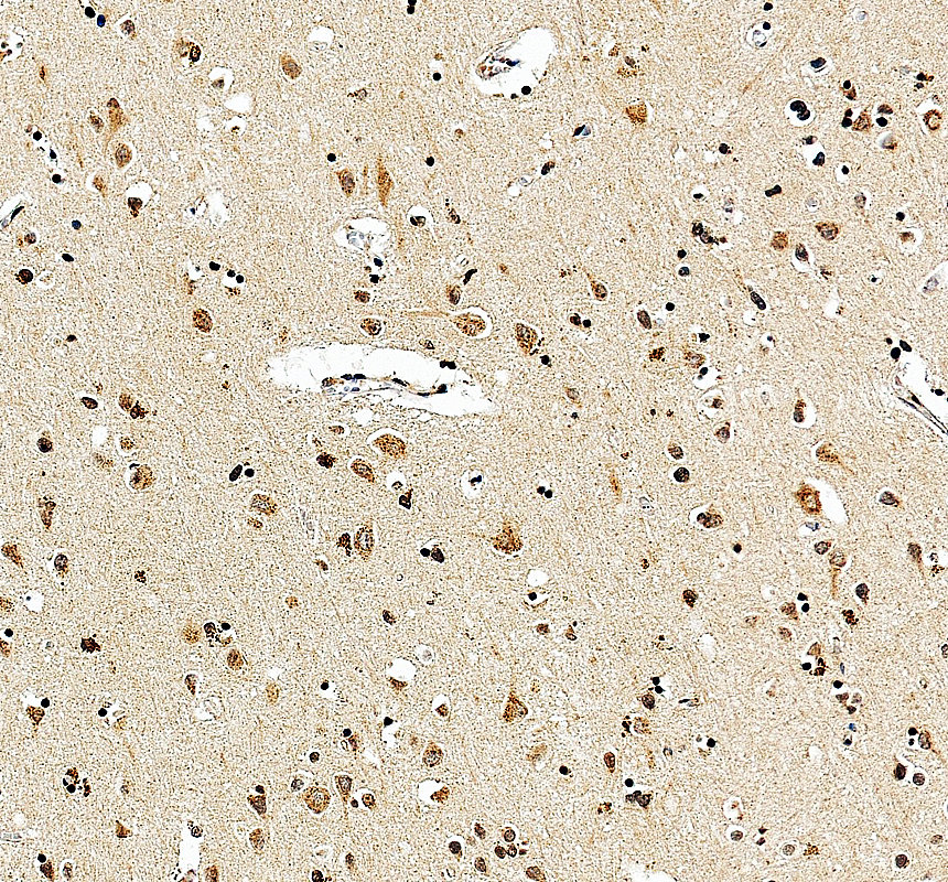 IHC analysis of LNX1 using anti-LNX1 antibody (A06813-2)